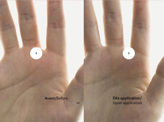 C93 — Itch Relief Cream 0.15% Enoxolone + Bisabolol