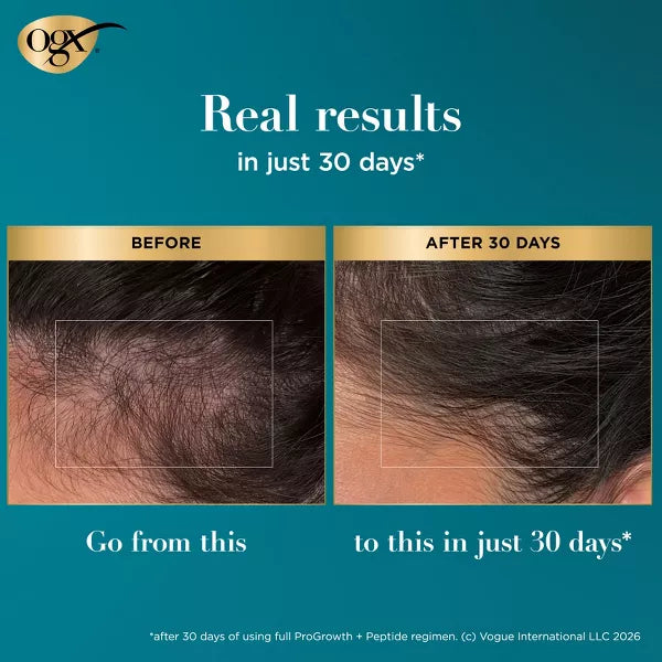 OGX ProGrowth+ Hair Strengthening Peptide Scalp Serum - 0.33 fl oz