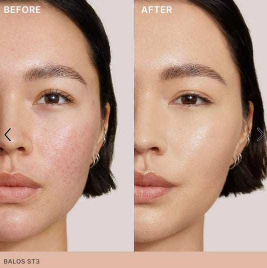 Super Serum Skin Tint SPF 40 - Fragrance-Free Foundation
