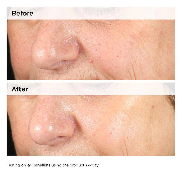 The Ordinary Alpha Arbutin 2% + HA Hyperpigmentation Serum