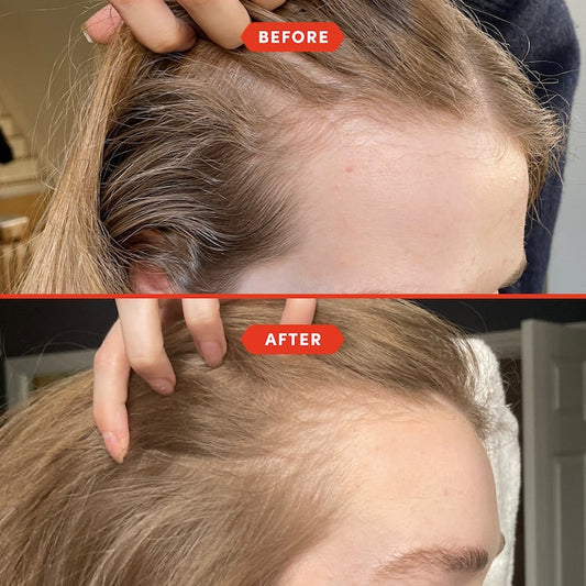Fable & Mane HoliRoots™ Pre-Wash Scalp & Hair Treatment Oil