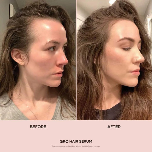 **Vegamour GRO Hair Serum – Thinning Hair Growth & Density Treatment**