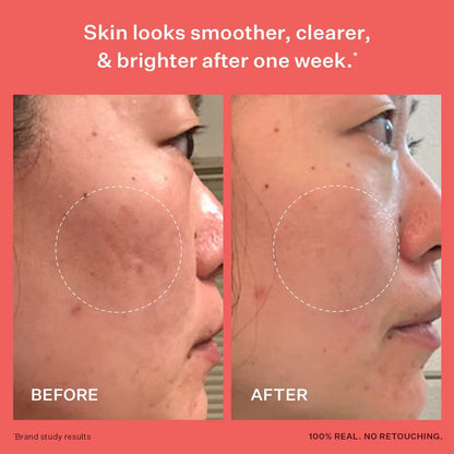 Glass Skin™ Smoothing & Refining Serum