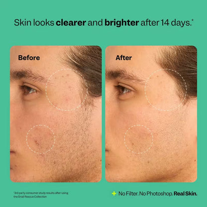 Snail Rescue Blemish Busting Toner