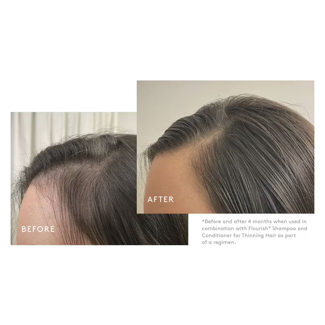 Flourish Advanced Hair Density & Growth Booster