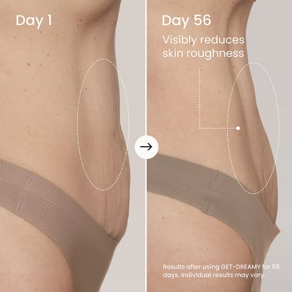 GET-DREAMY Overnight Body Sculpting Whip