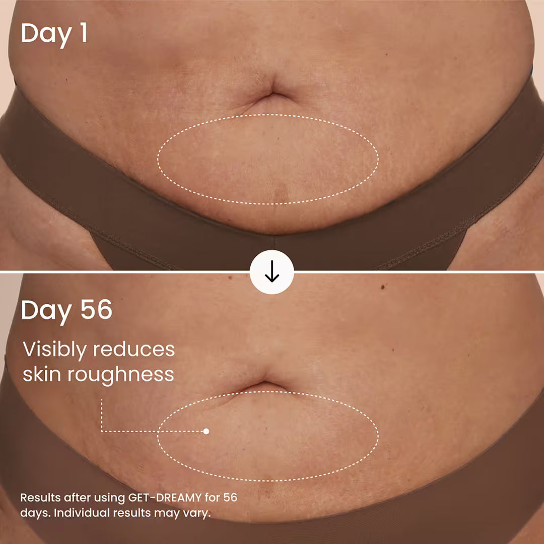GET-DREAMY Overnight Body Sculpting Whip