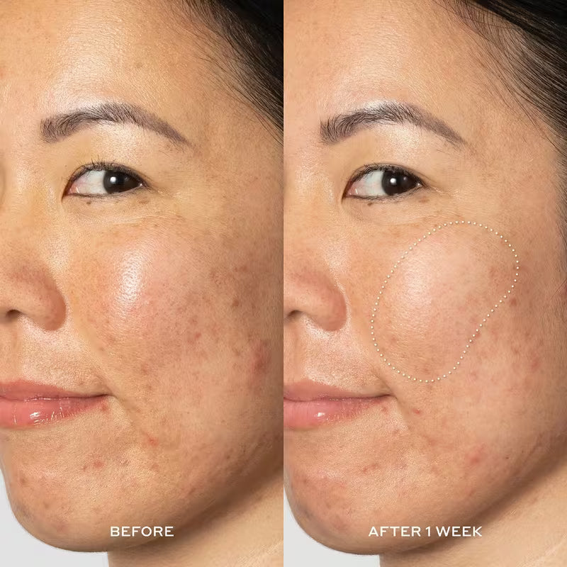 Glow2OH Exfoliating Dark Spot Toner with Glycolic & Lactic Acid