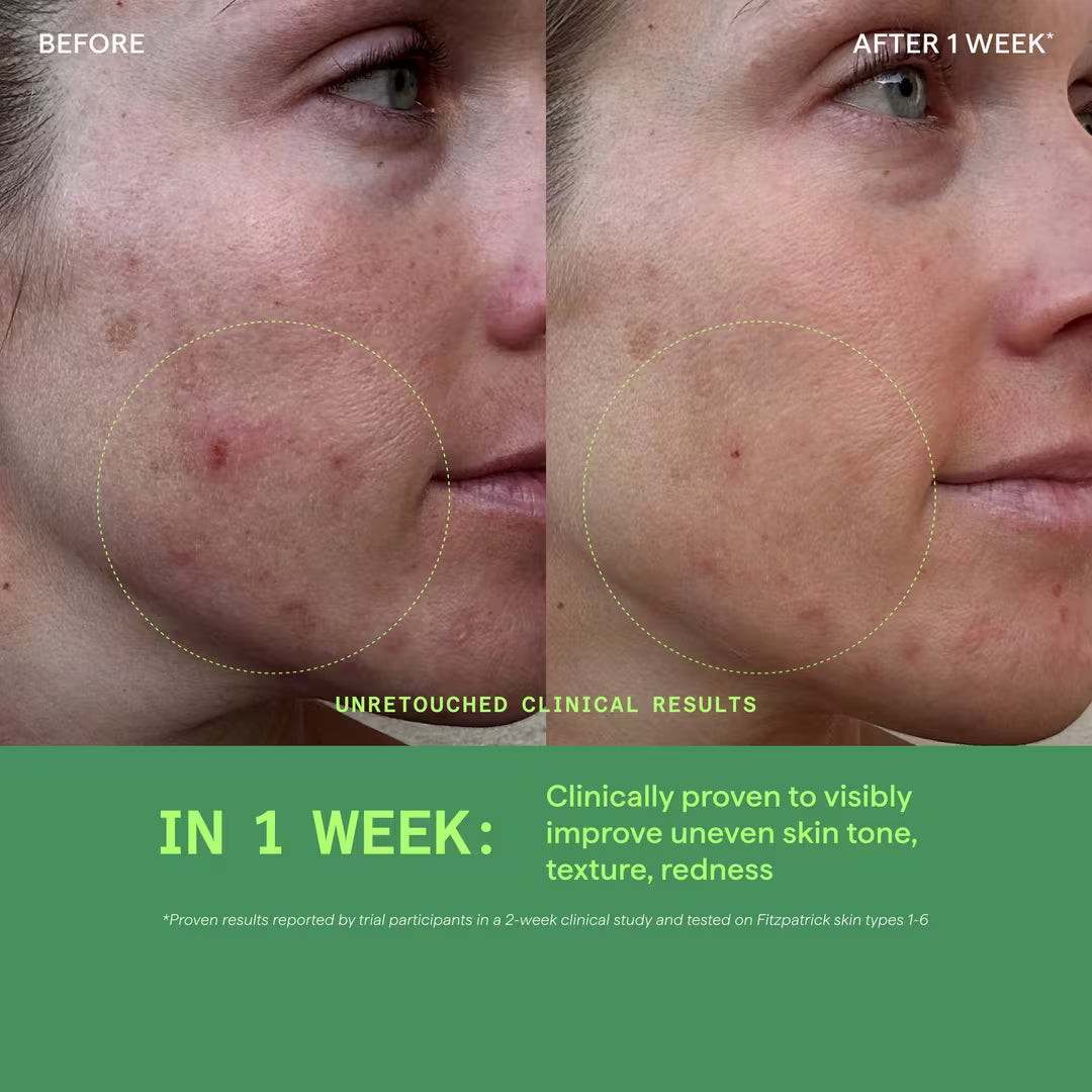 Biome-Balancing Redness Relief Cream