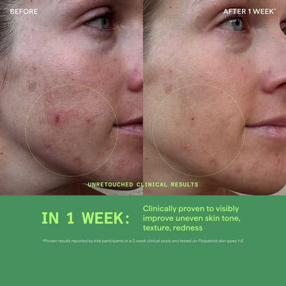 Biome-Balancing Redness Relief Cream