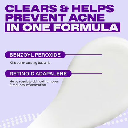 Differin Epiduo Acne Treatment Gel - Clears Breakouts & Unclogs Pores, 45g / 1.6 oz