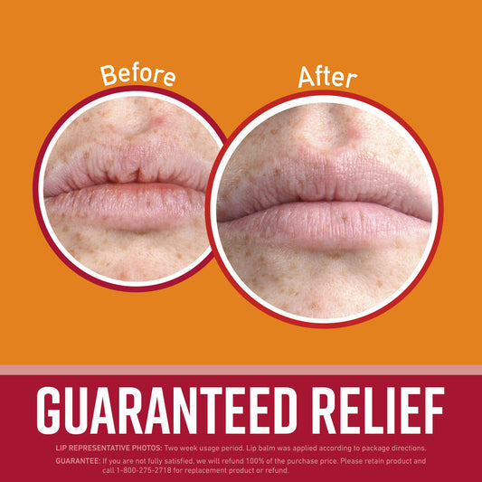 O'Keeffe's Cherry & Vitamin E Lip Repair® Lip Balm – 2 Count