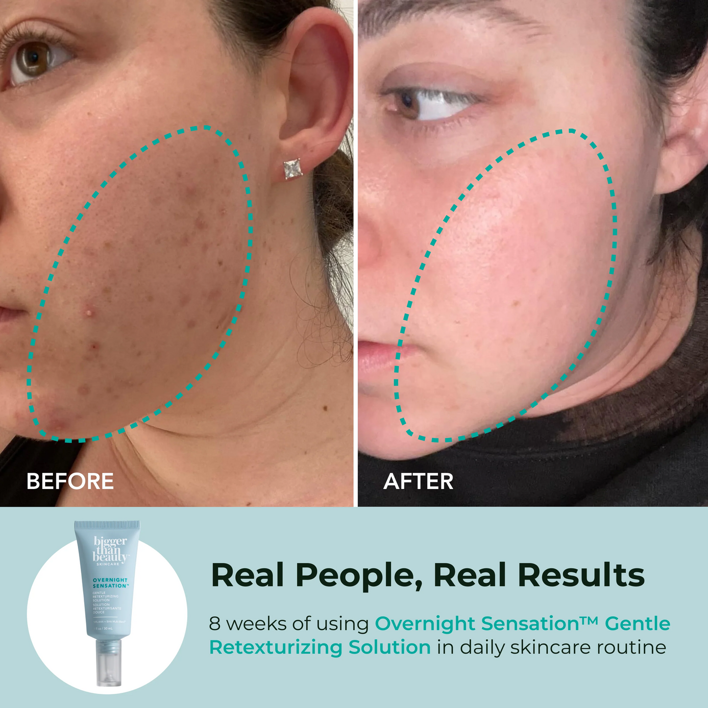 Overnight Sensation™ Gentle Retexturizing Solution