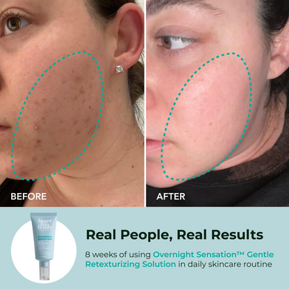 Overnight Sensation™ Gentle Retexturizing Solution