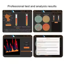 **2026 AI Skin Analyzer – Intelligent Facial & Hair Moisture Tester**