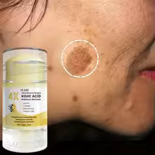 Kojic Acid Whitening Cream Stick – Even Tone & Moisturizing