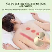 Smart Cupping Massager – 9-Level Vacuum Suction & Red Light Therapy