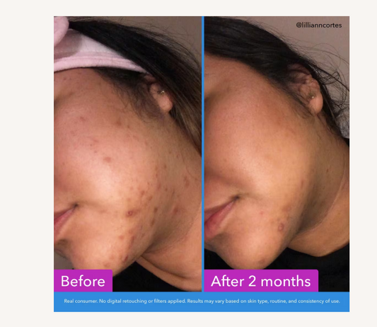 Discoloration Correcting Serum