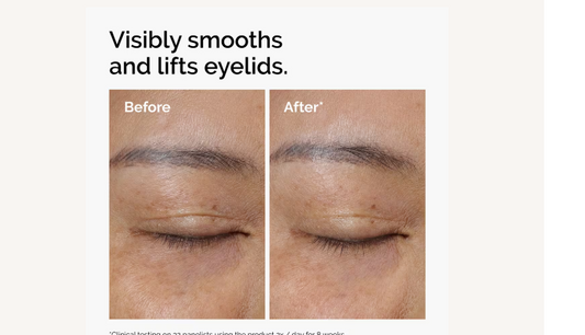 Lacto-PDRN 4% + B9 Eye Cream