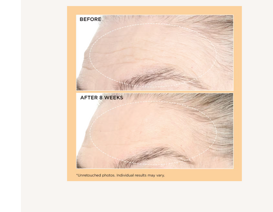 Neuropeptide Pro-Strength Moisturizer