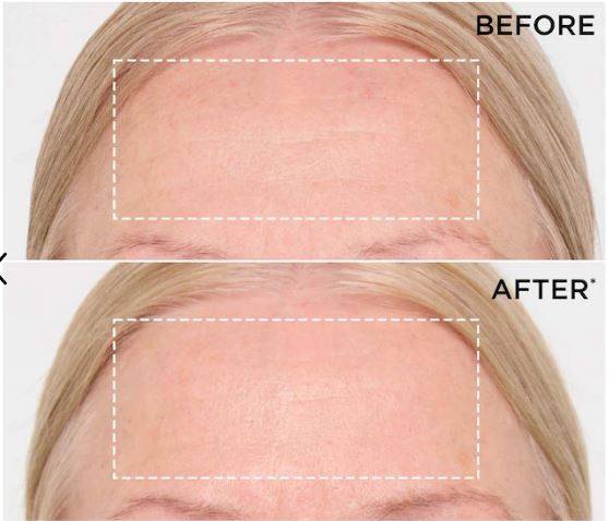 DOUBLE SERUM® – Firm, Brighten & Minimize Pores for Radiant Skin