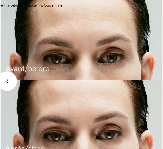 A43 — Targeted Skin-Tightening Concentrate 10% Inhibiting Peptide Complex + Hyaluronic Acid