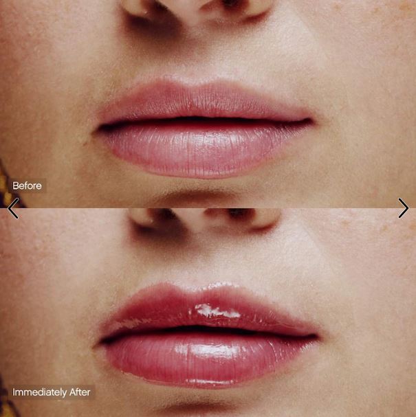 Slick Salve Glossy Lip Balm for Soothing + Hydration