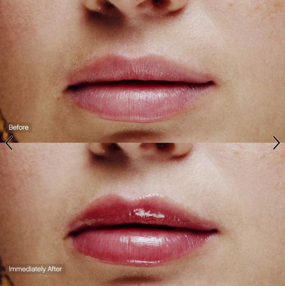 Slick Salve Glossy Lip Balm for Soothing + Hydration