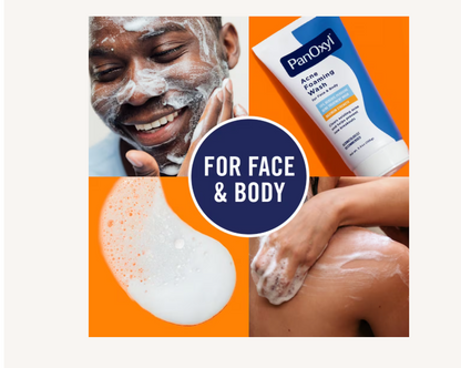 Acne Foaming Wash with 10% Benzoyl Peroxide