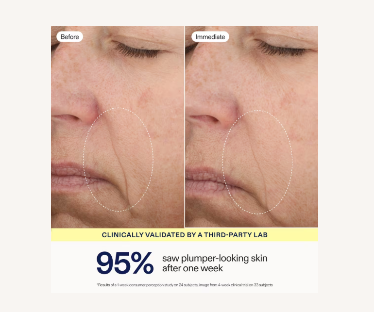 Triple Lipid Activating Serum