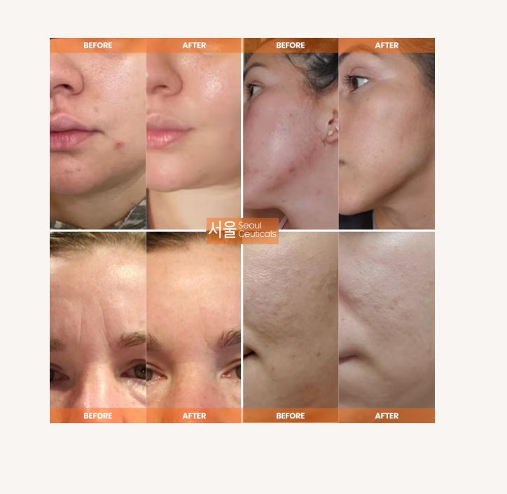 Korean Skin Care Multi-Function All-In-One Anti-Aging Snail Repair Cream