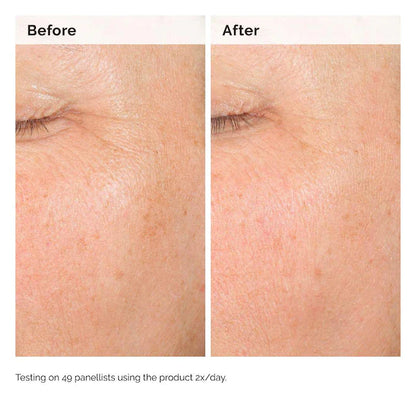 The Ordinary  Alpha Arbutin 2% + HA Hyperpigmentation Serum