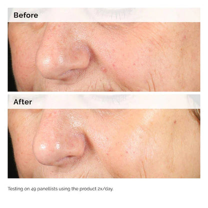 The Ordinary  Alpha Arbutin 2% + HA Hyperpigmentation Serum