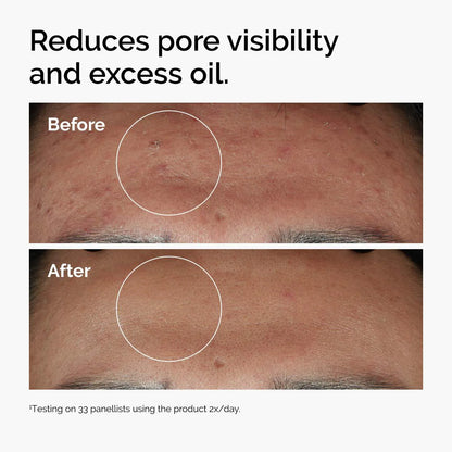 The Ordinary  Niacinamide 10% + Zinc 1%  Serum for Oily Skin