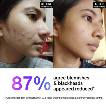 The INKEY List  Salicylic Acid Acne + Blackhead Cleanser