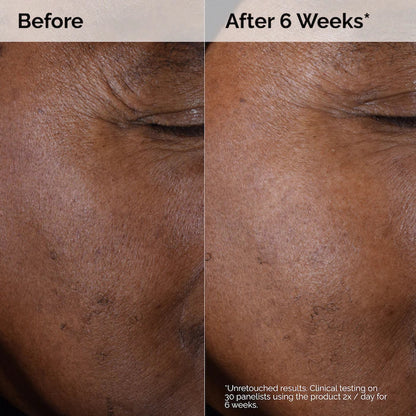 The Ordinary  Glycolic Acid 7% Exfoliating Toner