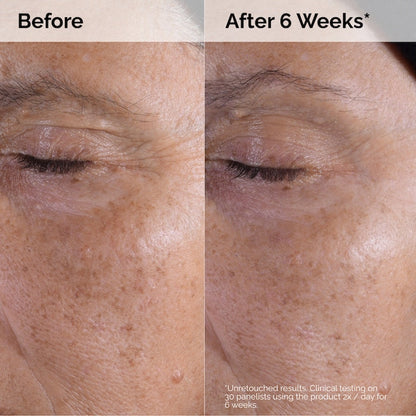The Ordinary  Glycolic Acid 7% Exfoliating Toner
