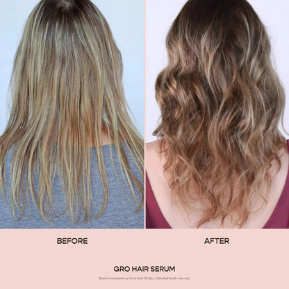 **Vegamour GRO Hair Serum – Thinning Hair Growth & Density Treatment**