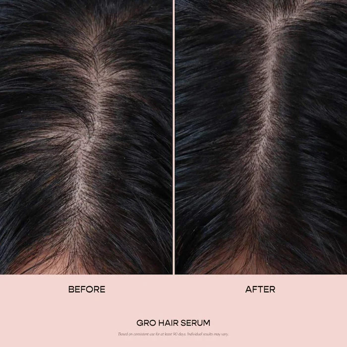 Vegamour  GRO Hair Serum for Thinning Hair