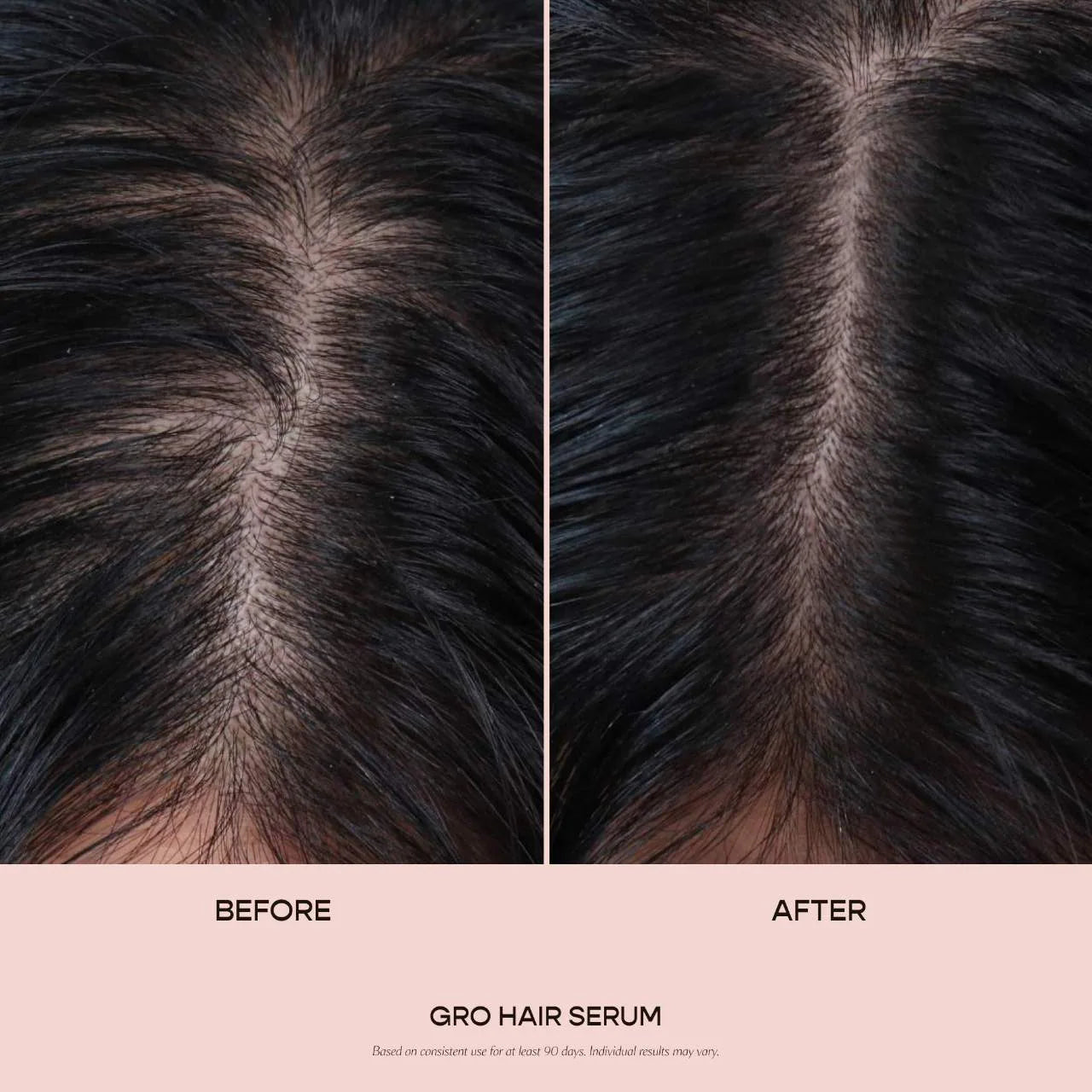 **Vegamour GRO Hair Serum – Thinning Hair Growth & Density Treatment**