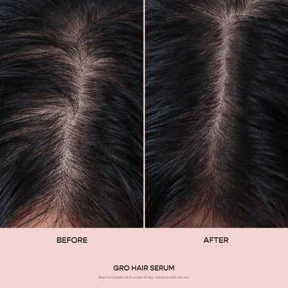 **Vegamour GRO Hair Serum – Thinning Hair Growth & Density Treatment**