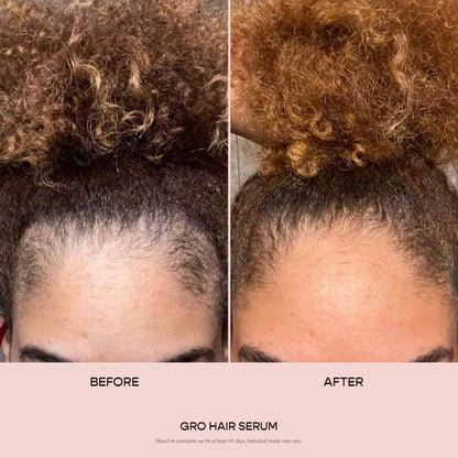 **Vegamour GRO Hair Serum – Thinning Hair Growth & Density Treatment**