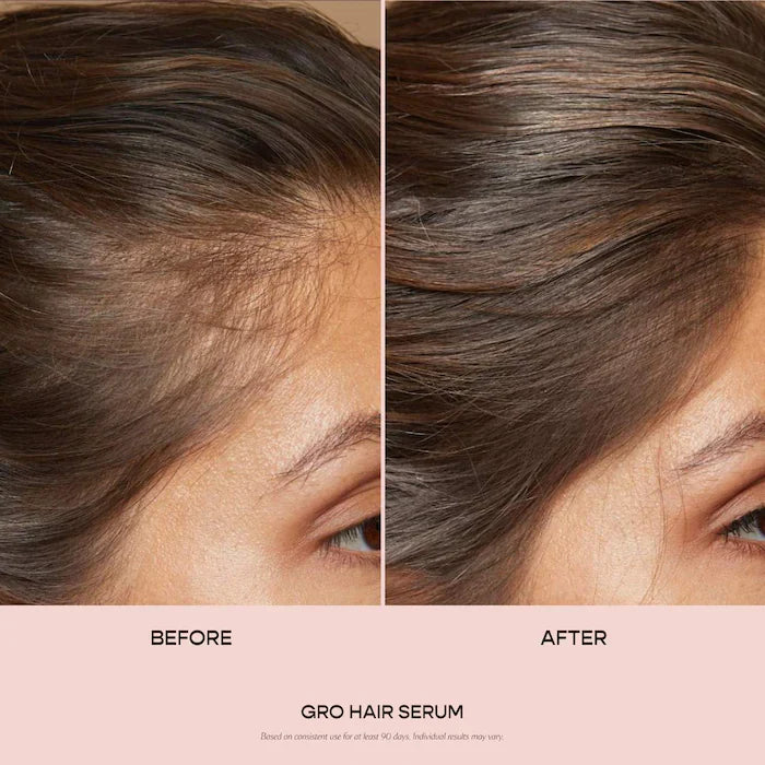 Vegamour  GRO Hair Serum for Thinning Hair