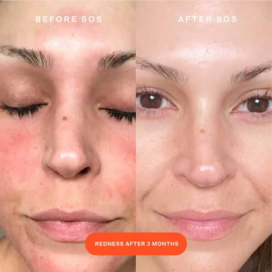 Tower 28 Beauty  SOS Daily Rescue Facial Spray with Hypochlorous Acid