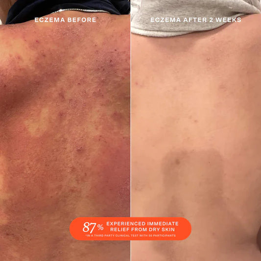 Tower 28 Beauty  SOS Daily Rescue Facial Spray with Hypochlorous Acid