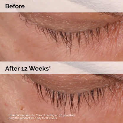 The Ordinary  Multi-Peptide Lash and Brow Serum