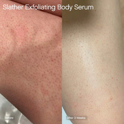 Topicals  Slather Exfoliating Body Serum with Retinol and AHAs