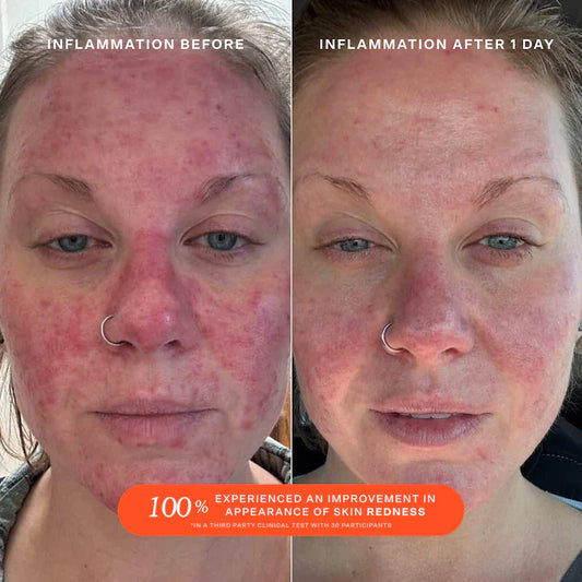 Tower 28 Beauty  Jumbo SOS Daily Rescue Facial Spray Refill with Hypochlorous Acid