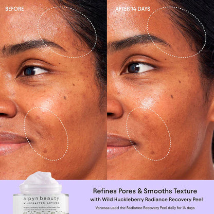 ALPYN  Polishing Peel & Brightening Face Mask with 8 Acids & Huckleberry