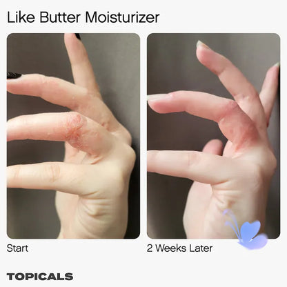 Topicals  Like Butter Moisturizer for Dry, Sensitive & Eczema-Prone Skin